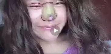 快手网红的双眼皮,快手网红的美丽蜕变之路